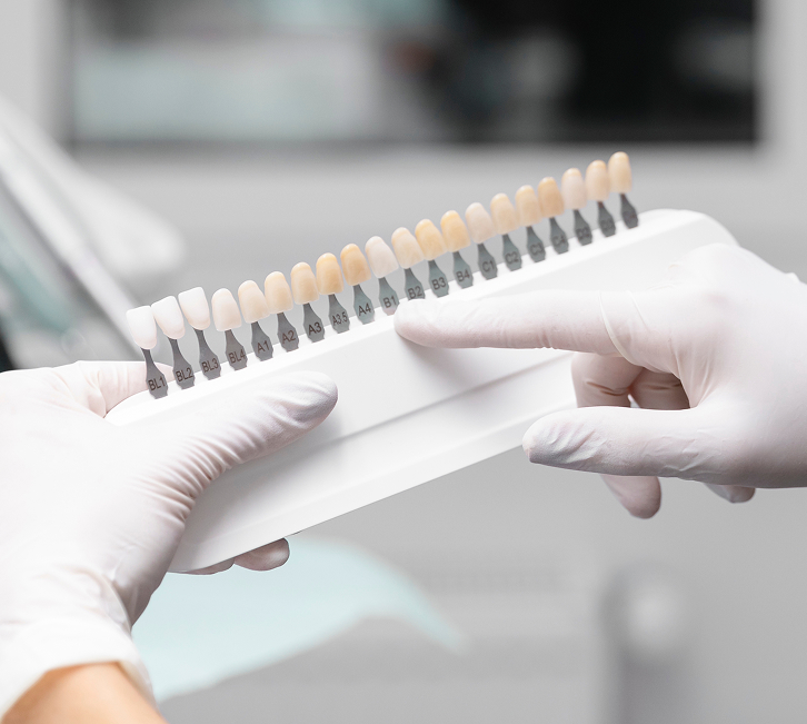 Imagen de carillas dentales