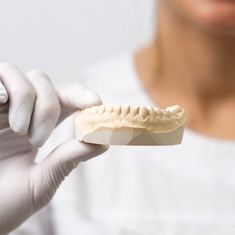 Una mano con guante de látex blanco sosteniendo una maqueta de yeso de la dentadura inferior de una persona