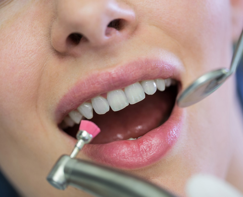 Vista de una boca abierta, con dos instrumentos haciendo una limpieza bucal
